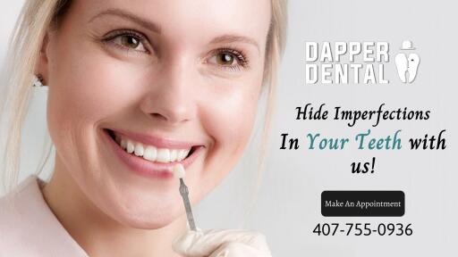 Are your suffering from chipped, cracked, or stained teeth? And if you are thinking about dental veneers treatment, don’t hesitate to reach out Dapper Dental office and make an appointment by filling out the form or call at 407-755-0936. We can help you to restore your smile and confidence with our exceptional services. For more details, connect with us online!