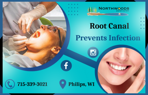 Experiencing tooth root pain and struggling how to get rid of it? We can help through root canal treatment removes infected regions and relieves pressure from pulp swelling. Contact us: Ladysmith@northwoodsdentistry.com.