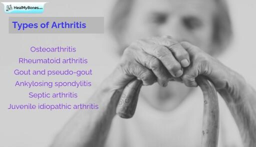 There are more than 50 different types of arthritis. A patient can have more than one type of arthritis. Heal my bones provide the best treatment for arthritis. Know 
more https://www.healmybones.com/articles/arthritis/types-of-arthritis.php