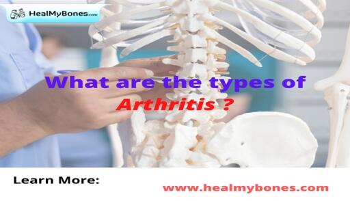 Joint pain can also be a symptom of arthritis. Dr. Manoj Kumar Khemani in Heal my bones treats more than 50 different types of arthritis. Know more https://www.healmybones.com/articles/arthritis/types-of-arthritis.php
