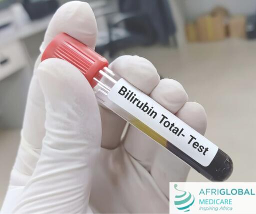 The bilirubin test is a simple blood test used to diagnose high levels of bilirubin in the blood. A high level of bilirubin in the blood can obstruct the bile ducts or gallbladder. If the bilirubin levels are high, your doctor may prescribe medication to reduce the levels. To schedule a Bilirubin Test visit Afriglobal Medicare. For more information about us, visit our website.https://www.afriglobalmedicare.com/uses-of-a-bilirubin-test-and-why-you-should-carry-out-one-this-breastfeeding-week/