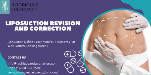 Liposuction is a popular option for people who wants to improve their appearance through weight loss. When you are looking for liposuction doctors in Houston who can offer you the best results then get in touch with Rodriguez Rejuvenation. Dr. Rodriguez is one of the most respected and certified doctors in the Houston area. One small mistake during a procedure can have negative consequences for the individual. Contact here for the best results.