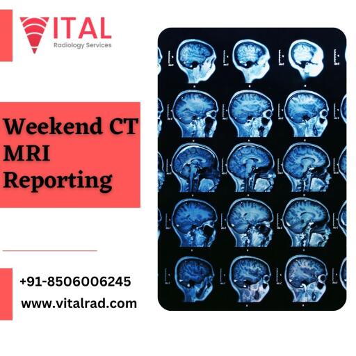 At Vital Radiology Services, we are available 24 hours a day, seven days a week, and can cater to all the needs of weekend CT MRI reporting services. We offer the most advanced and high-quality reporting services through our cutting-edge technology and well-qualified radiology specialists. We can also provide you with outsourcing for radiology reporting. Visit our website to get more information.

Visit us: https://www.vitalrad.com/about-us